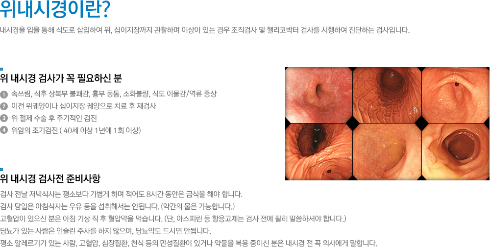 위내시경이란? 내시경을 입을 통해 식도로 삽입하여 위, 십이지장까지 관찰하며 이상이 있는 경우 조직검사 및 헬리코박터 검사를 시행하여 진단하는 검사입니다.
